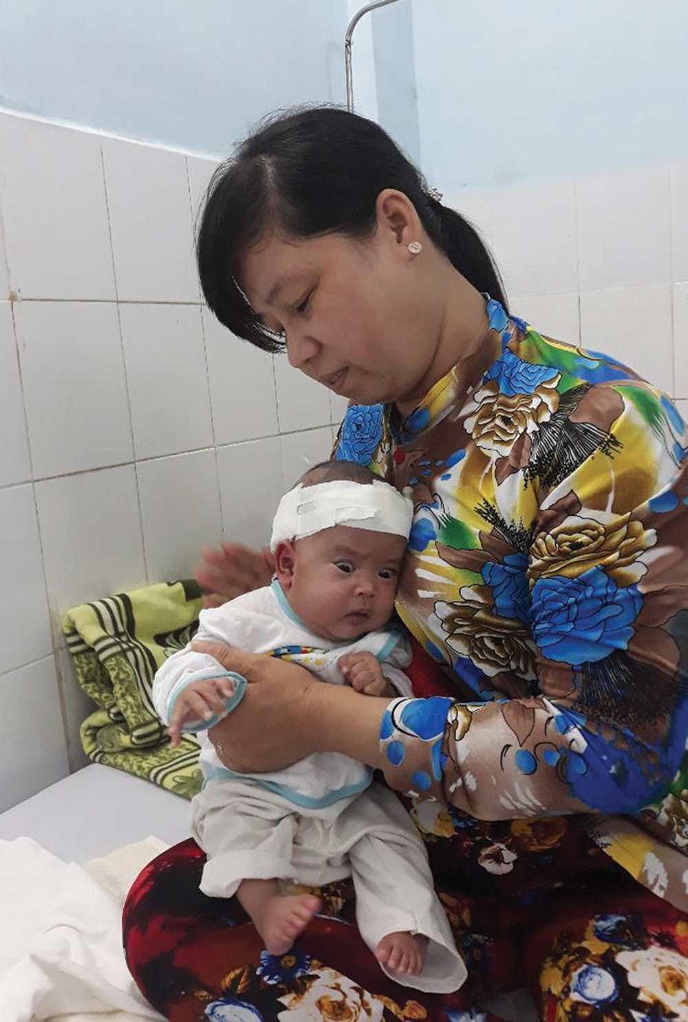 Bé sơ sinh bị não úng thủy và thoát vị tủy cần giúp đỡ