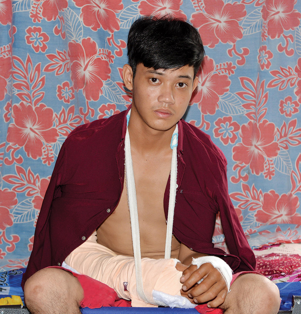 Liêu Kim Phi với vết thương ở hai cánh tay do sét đánh