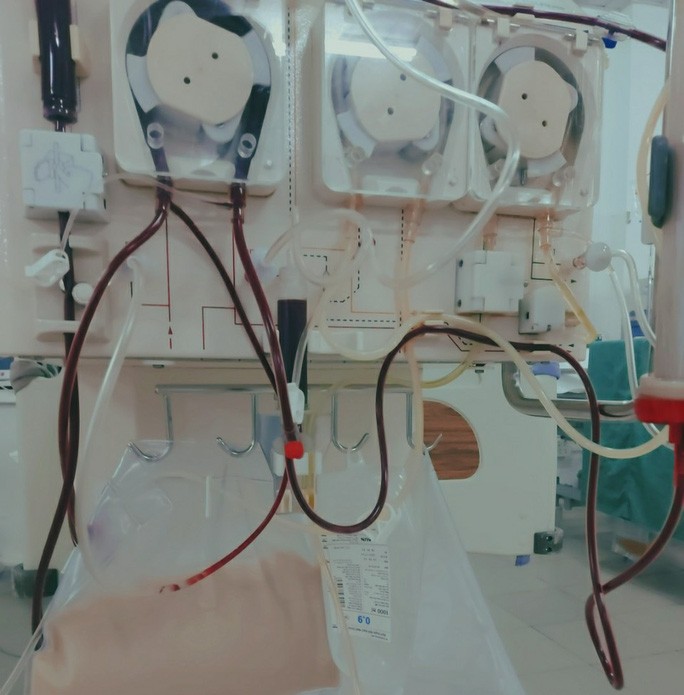 90 giờ lọc máu liên tục cứu sống sản phụ cận kề cái chết