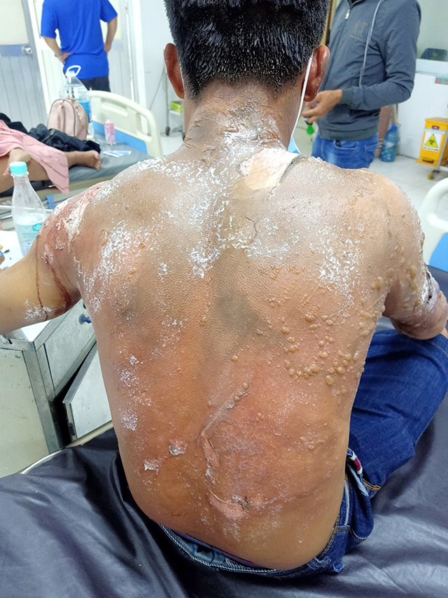 Đồng Tháp: Mâu thuẫn nhỏ - Hậu quả lớn