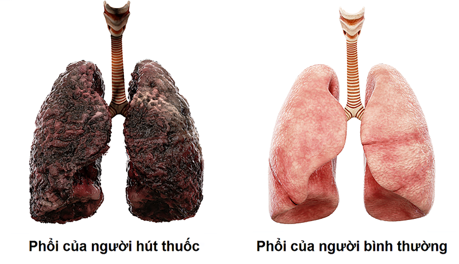 Thuốc lá và các bệnh về hô hấp