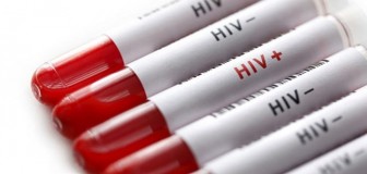 Tin vui đầu năm, 36 người ở Kon Tum may mắn âm tính với HIV