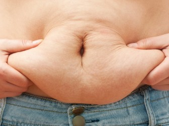 Bệnh béo phì có thể ‘lây lan’
