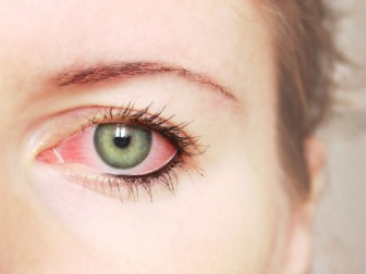 4 dấu hiệu bất thường ở mắt báo động sức khỏe bất ổn