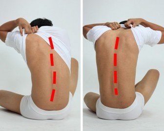 10 cách trị chứng đau lưng cho dân văn phòng
