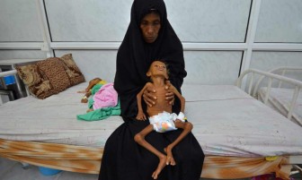 Nạn đói ở Yemen có thể trở thành "sự kiện kinh hoàng" nhất lịch sử nhân loại