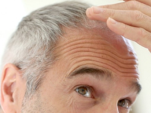 4 điều nhiều người chưa biết về tóc bạc