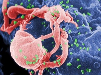 Thêm bệnh nhân thứ 3 chữa khỏi HIV