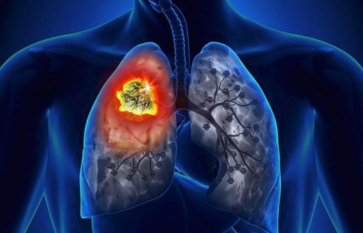 Đáng sợ những căn bệnh chết người do thuốc lá