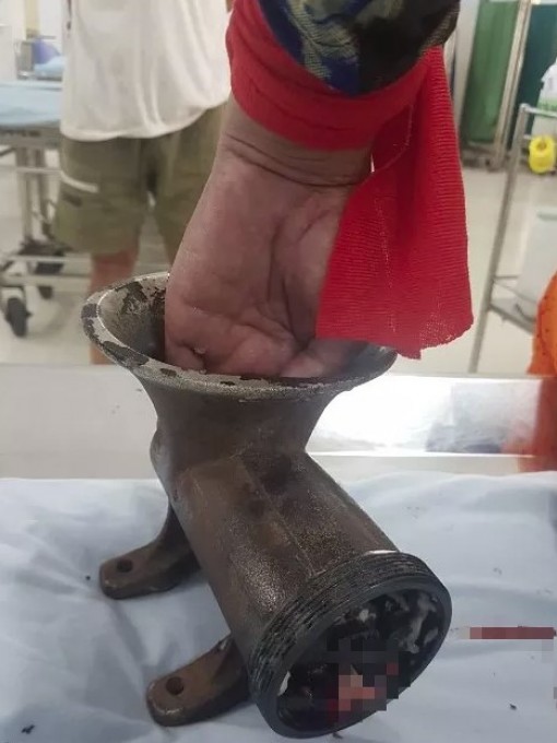 Đồng Tháp: Một phụ nữ bị máy xay thịt "nuốt" gần hết bàn tay