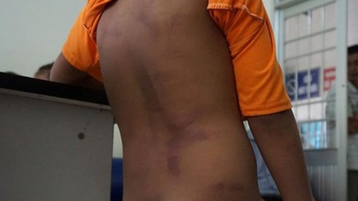 Chủ tịch UBND tỉnh Cà Mau chỉ đạo xử lý vụ 4 trẻ em nghi bị người thân bạo hành