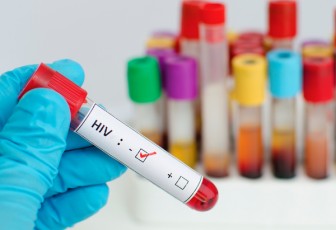 Nam Phi ra mắt thuốc điều trị HIV/AIDS hiệu quả cao