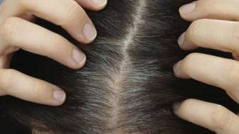Chuyên gia chỉ ra nguyên nhân vì sao bạc tóc gia tăng ở người trẻ?