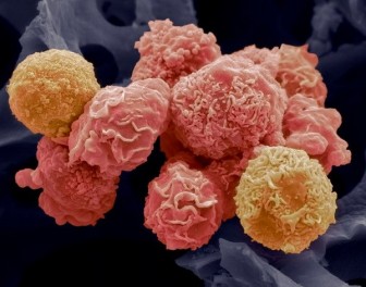 Công dụng diệt tế bào ung thư của nhiều loại thuốc không chữa ung thư