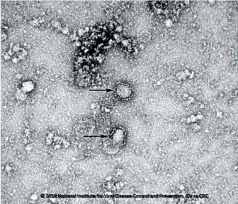 Hình ảnh đầu tiên về virus corona đang hoành hành Trung Quốc qua kính hiển vi