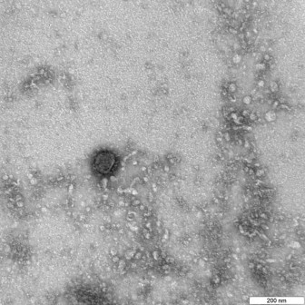 Các nhà khoa học Nga đã giải mã được bộ gen của virus SARS-CoV-2