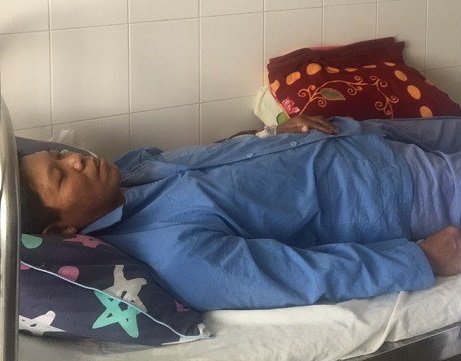 Cần Thơ: Can thiệp nội mạch cấp cứu một nông dân bị chảy máu mũi kéo dài