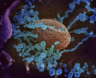 Các nhà khoa học Argentina giải mã thành công bộ gien của virus SARS-COV-2