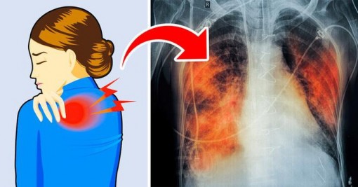 Có 5 dấu hiệu này chứng tỏ phổi của bạn đang 'kêu cứu', tuyệt đối không được chủ quan