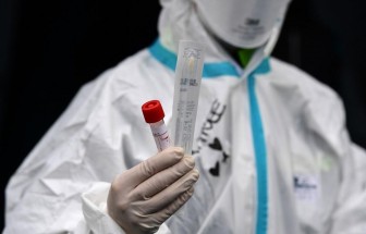 Italy: Vùng Lombardy xét nghiệm máu tìm người có kháng thể với virus