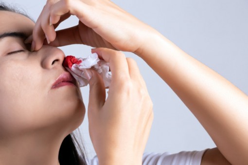 Bị chảy máu mũi do đâu?