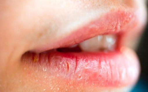 8 dấu hiệu trên mặt cảnh báo dễ mắc bệnh nguy hiểm