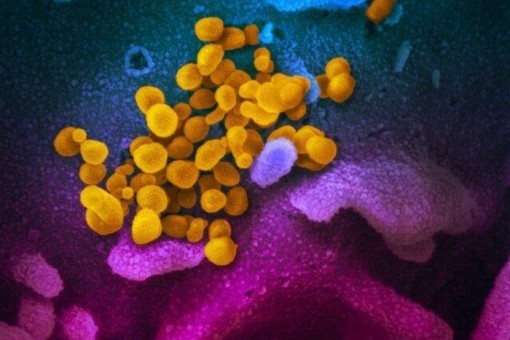 Virus SARS-CoV-2 có khả năng bị phát tán khi nói