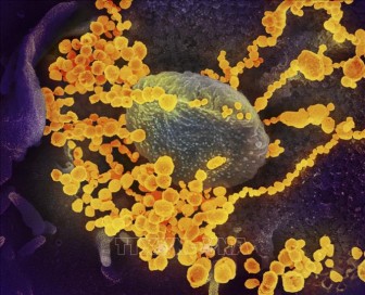 Nhật Bản cho phép xét nghiệm virus SARS-CoV-2 qua nước bọt