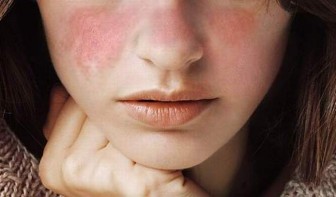 6 dấu hiệu bất thường trên khuôn mặt “hé lộ” những bệnh nguy hiểm sắp ập đến