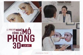 Công nghệ mô phỏng 3D tại thẩm mỹ Thanh Tuyền