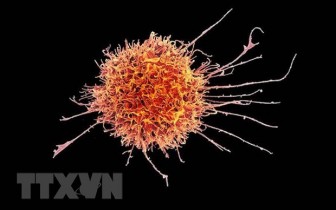 Bước tiến mới trong ngăn chặn tế bào ung thư phát triển