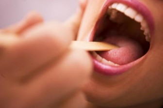 Dấu hiệu ở lưỡi cảnh báo bệnh ung thư