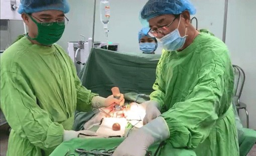 Cần Thơ: Quên rút ống sonde 9 năm, sỏi bám to bằng quả trứng