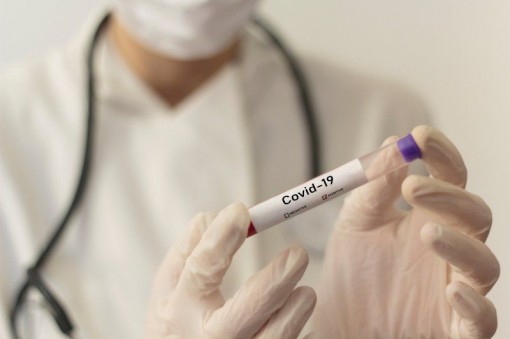 An Giang: 16 trường hợp F1 tiếp xúc ca bệnh âm tính với virus SARS-CoV-2