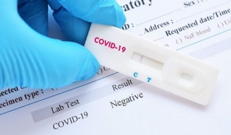 Bệnh viện Đa khoa Bình Dân được phép xét nghiệm nhanh kháng nguyên virus SARS-CoV-2