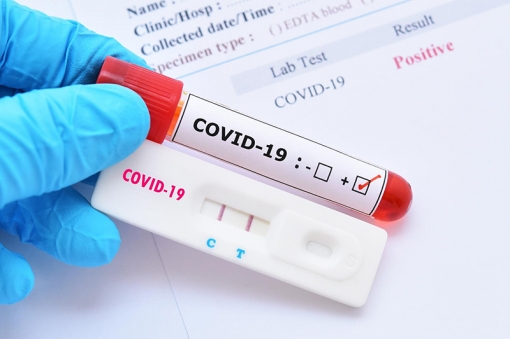 Thoại Sơn ghi nhận 1 ca dương tính Sars-CoV-2 ở xã Định Thành