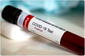 TP. Long Xuyên truy vết 5 ca nghi nhiễm COVID-19