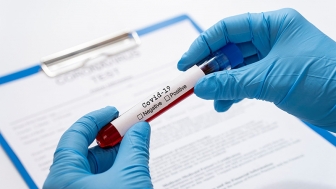 Công nhân Công ty TNHH gạo Vinh Phát Wilmar có kết quả PCR âm tính với SARS-CoV-2
