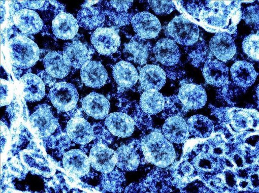 Người nhiễm biến thể Delta có thể lây lan virus 2 ngày trước khi có triệu chứng