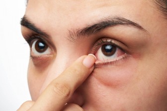 Dấu hiệu ở mắt cảnh báo bệnh tiểu đường, không chữa sớm có thể gây mù lòa