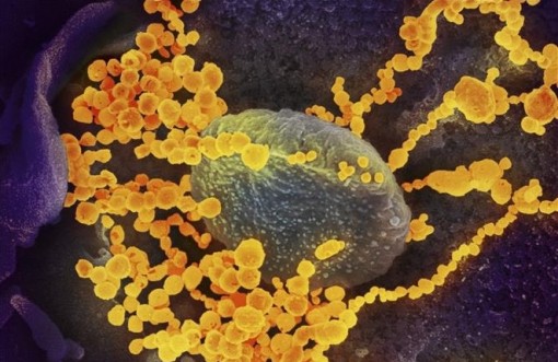Hà Lan phát hiện đường dây cung cấp virus SARS-CoV-2