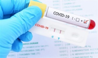 Bộ Y tế ban hành giá xét nghiệm COVID-19 mới: Giảm 30% so với trước