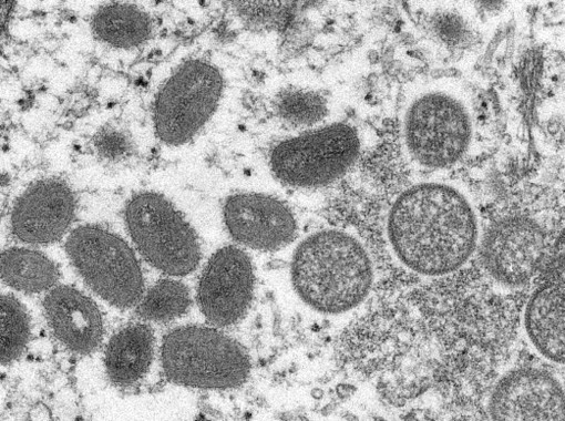 WHO: Không có bằng chứng cho thấy virus đậu mùa khỉ đã biến đổi