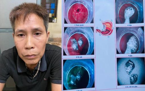 Gặp công an, nuốt luôn ma túy phi tang