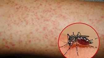 UBND tỉnh An Giang ban hành kế hoạch chiến dịch diệt lăng quăng phòng, chống bệnh sốt xuất huyết Dengue 3 đợt
