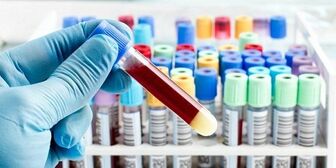 Xét nghiệm máu có tầm soát được ung thư hay không?