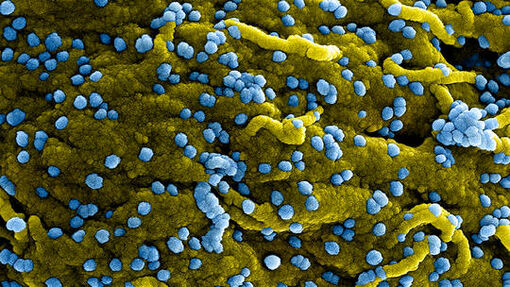 WHO tăng cường giám sát sau khi Guinea Xích đạo công bố dịch bệnh do virus Marburg