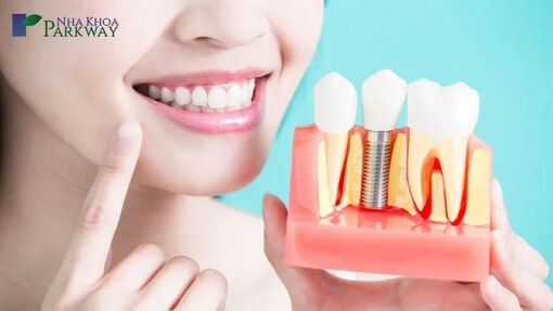 Trồng răng implant có niềng răng được không?