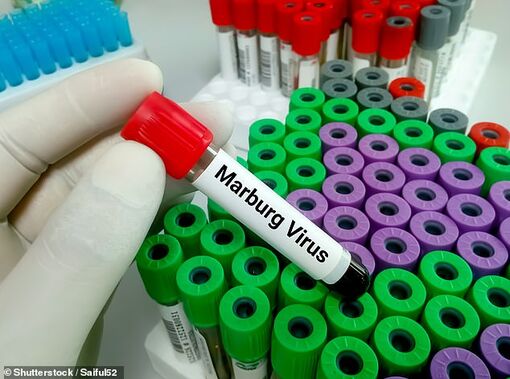 Bùng phát virus Marburg gây tử vong cao ở Tanzania