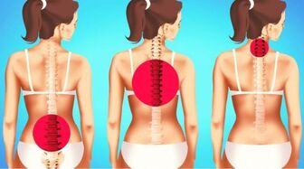 Bài tập thể dục hiệu quả cho người bị đau lưng, phòng ngừa bệnh về cột sống